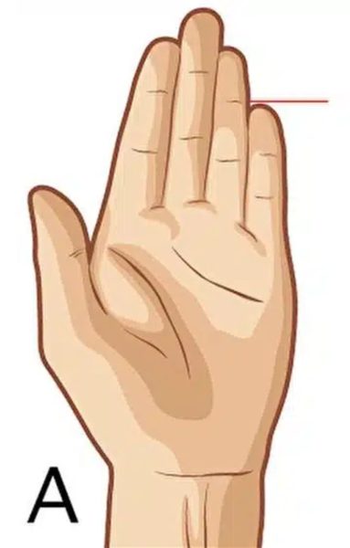 Petit doigt et annulaire au même niveau